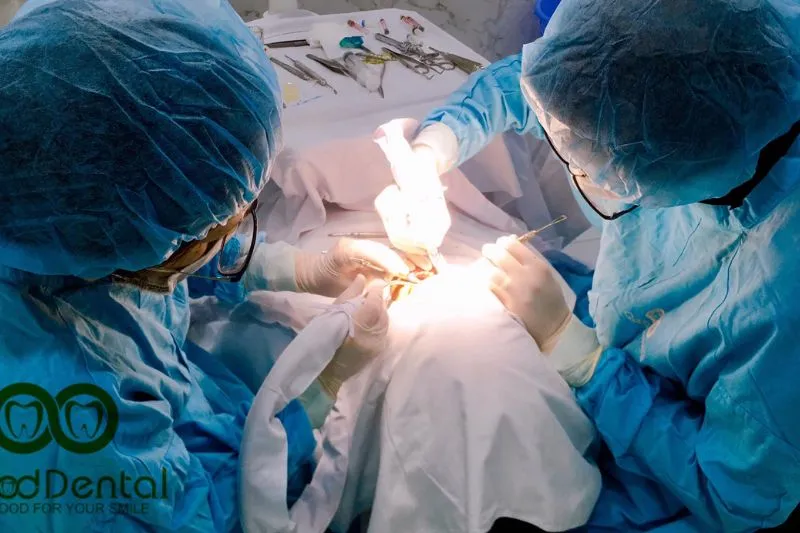 So Sánh Chi Phí Bọc Răng Sứ Ở Việt Nam Và Mỹ